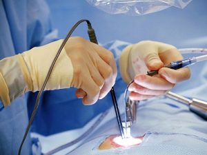 Малоинвазивная эндоскопическая хирургия в Израиле
